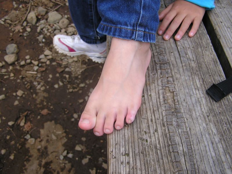 丹沢表尾根 -- 靴擦れ